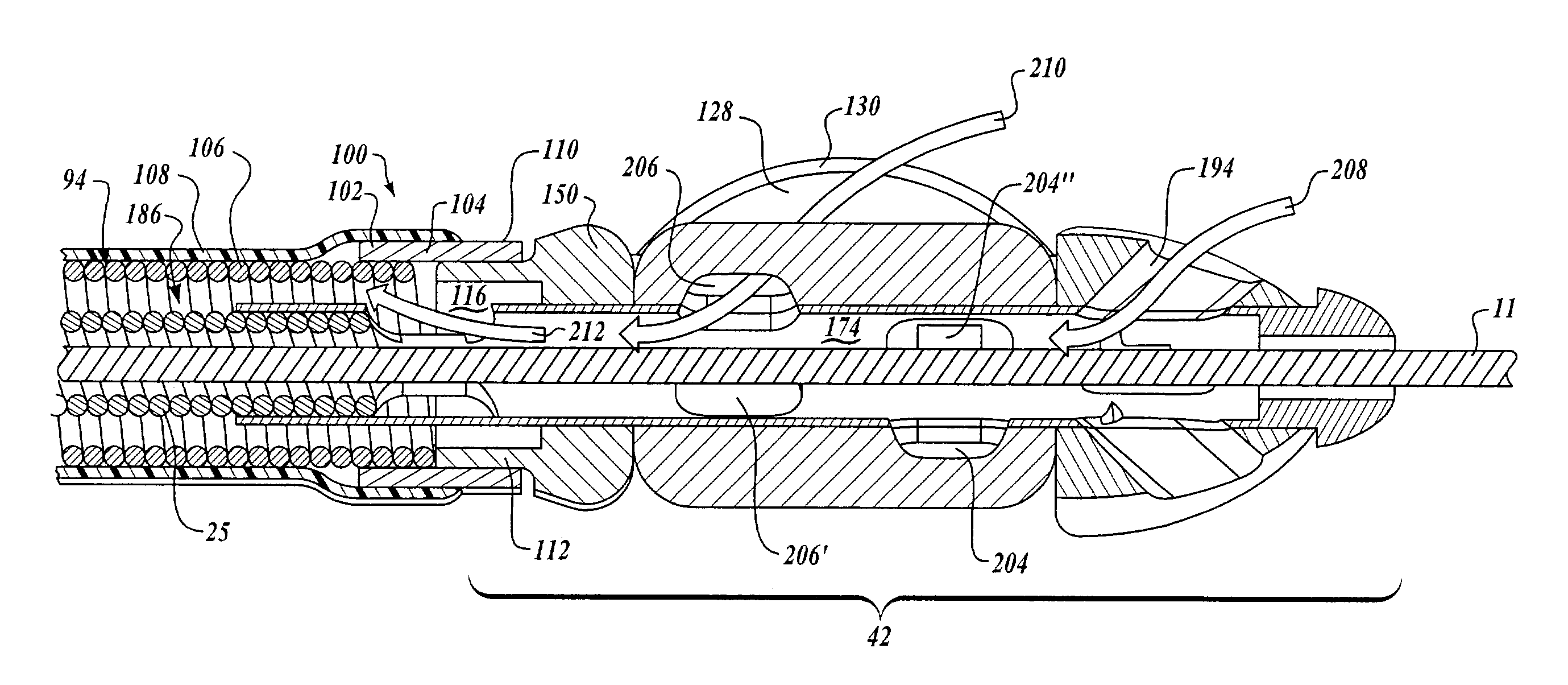 Intralumenal material removal using a cutting device for differential cutting