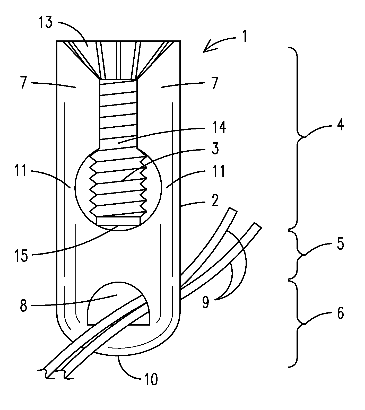 Knotless suture fixation device and method