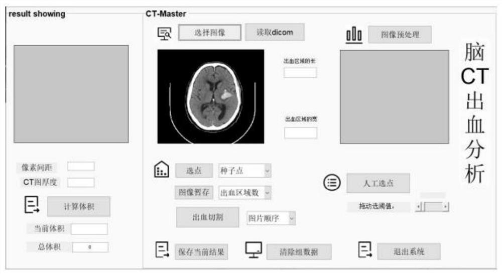 Cerebral hemorrhage CT slice scanning analysis system