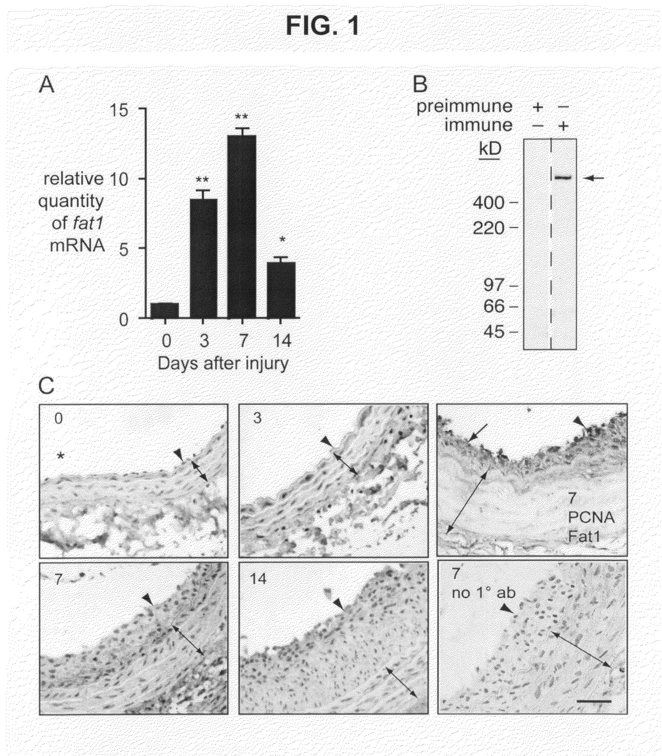 Methods and compositions for regulating proliferation and migration of vascular smooth muscle cells