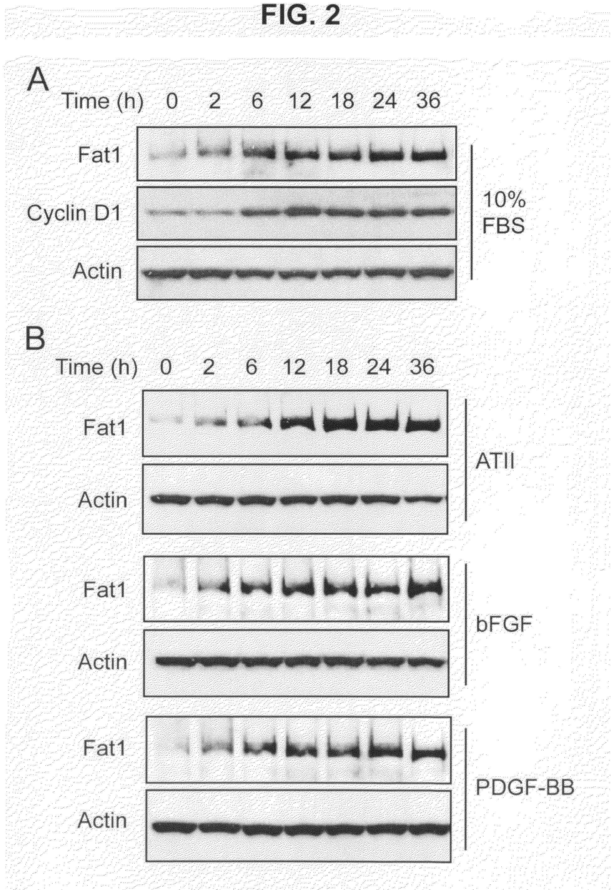 Methods and compositions for regulating proliferation and migration of vascular smooth muscle cells
