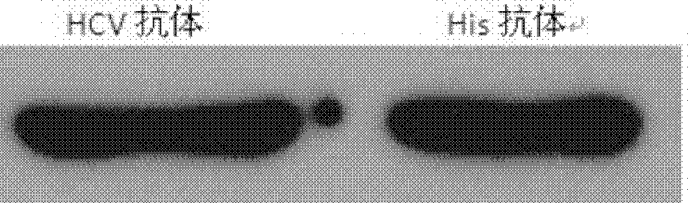 HCV (hepatitis C virus) core antigen and antibody thereof as well as hybridoma cell lines secreting antibody