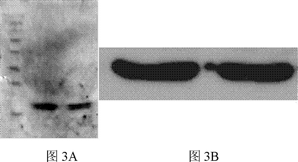 HCV (hepatitis C virus) core antigen and antibody thereof as well as hybridoma cell lines secreting antibody