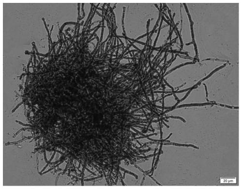 Application of high-temperature-resistant pleurotus ostreatus in production of ergothioneine