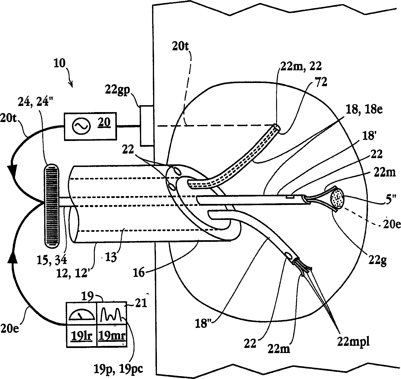 Impedance controlled tissue ablation apparatus and method