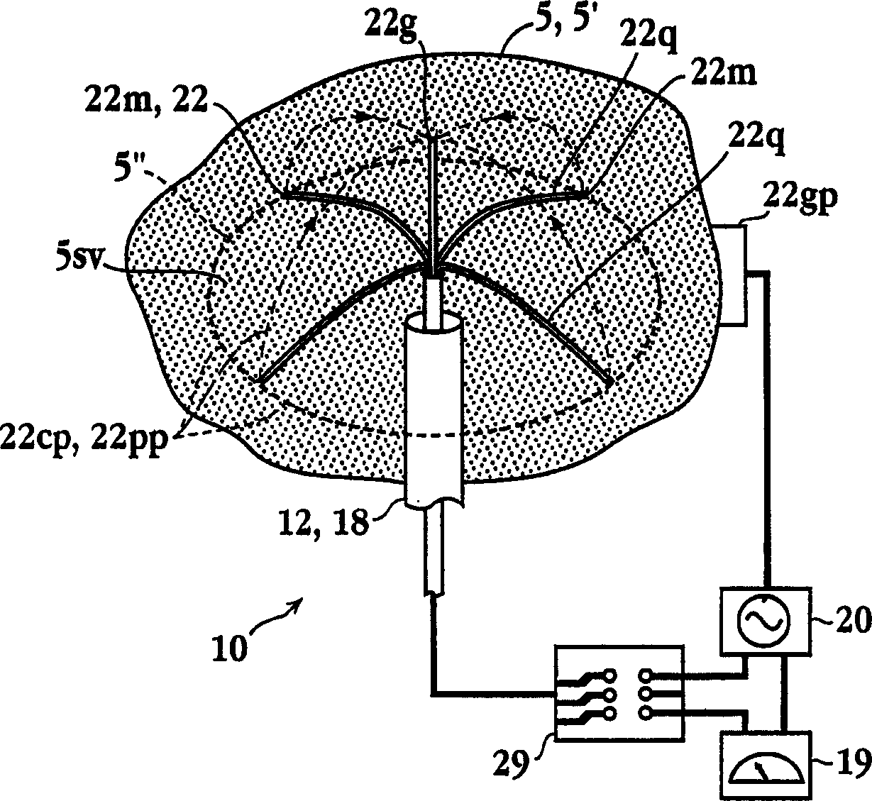 Impedance controlled tissue ablation apparatus and method