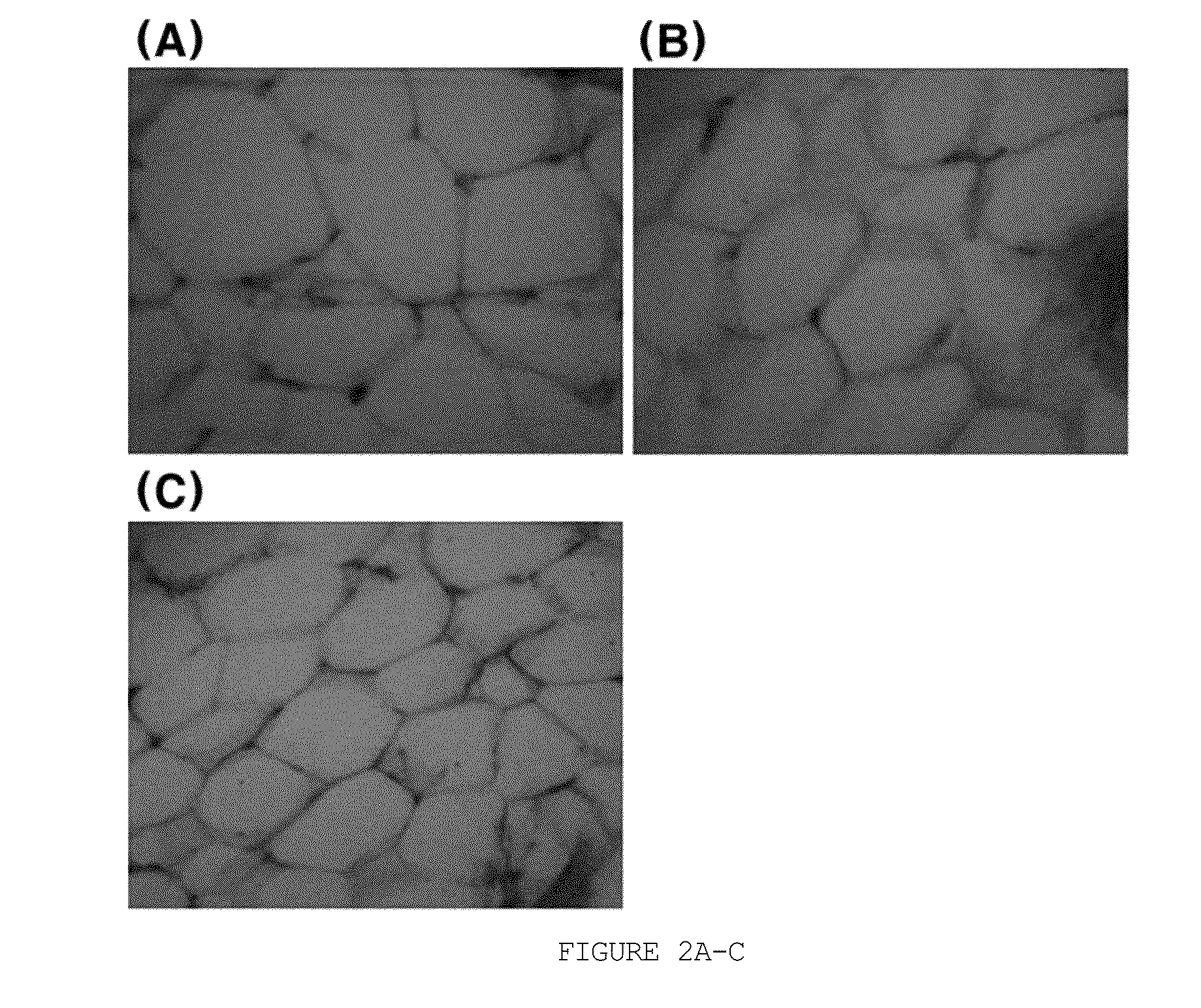 Method for screening of agent for treating or preventing obesity