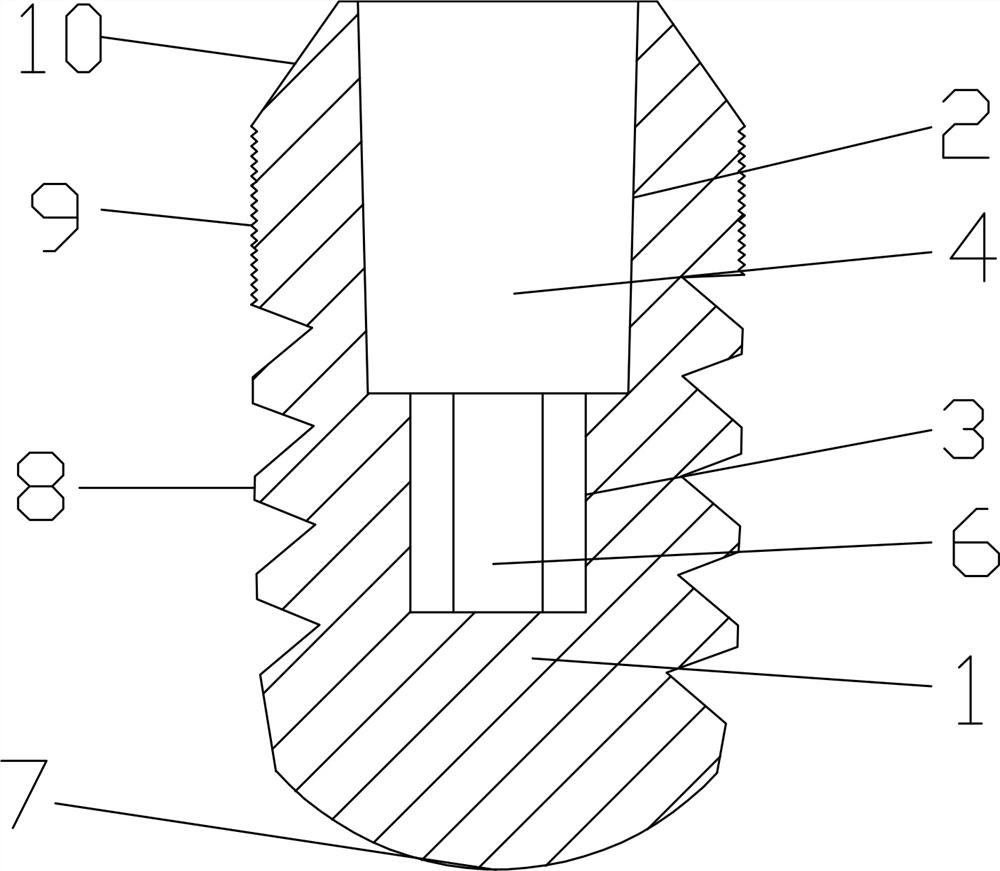 Implant abutment and fittings thereof, and taking and wearing method of implant abutment