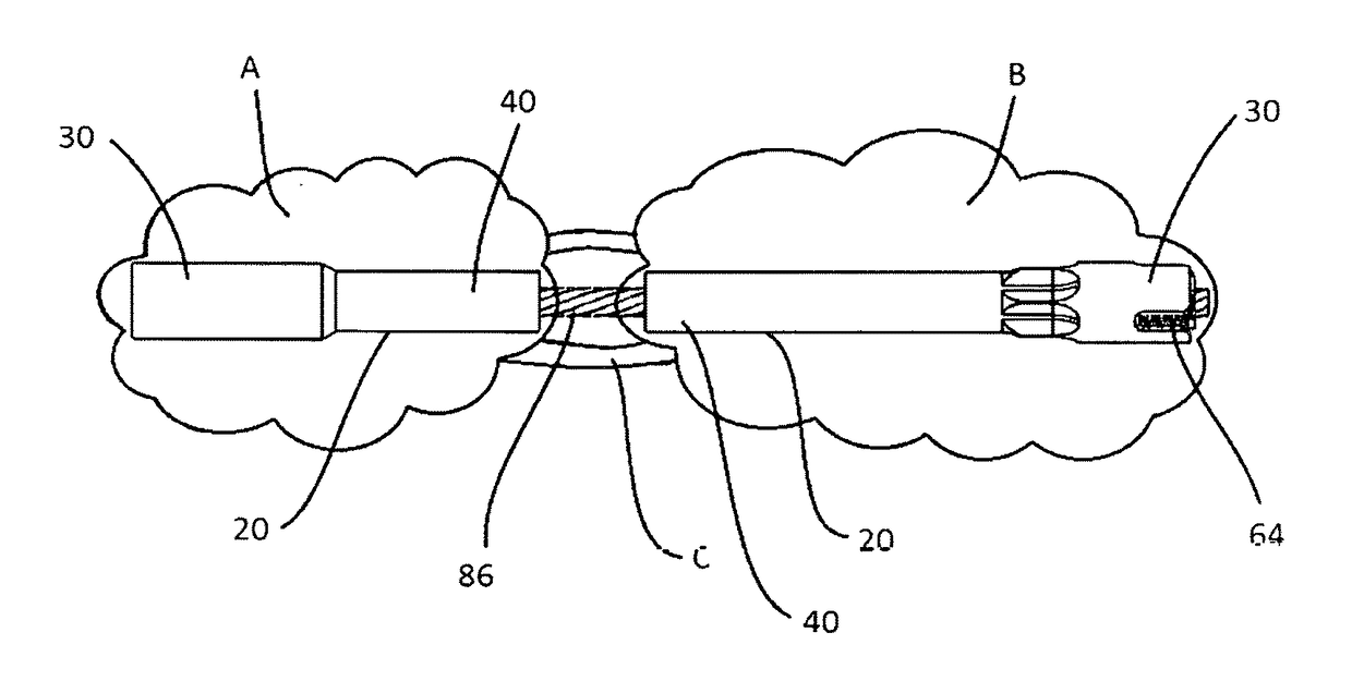 Apparatus and method for repair of disruptions between bones