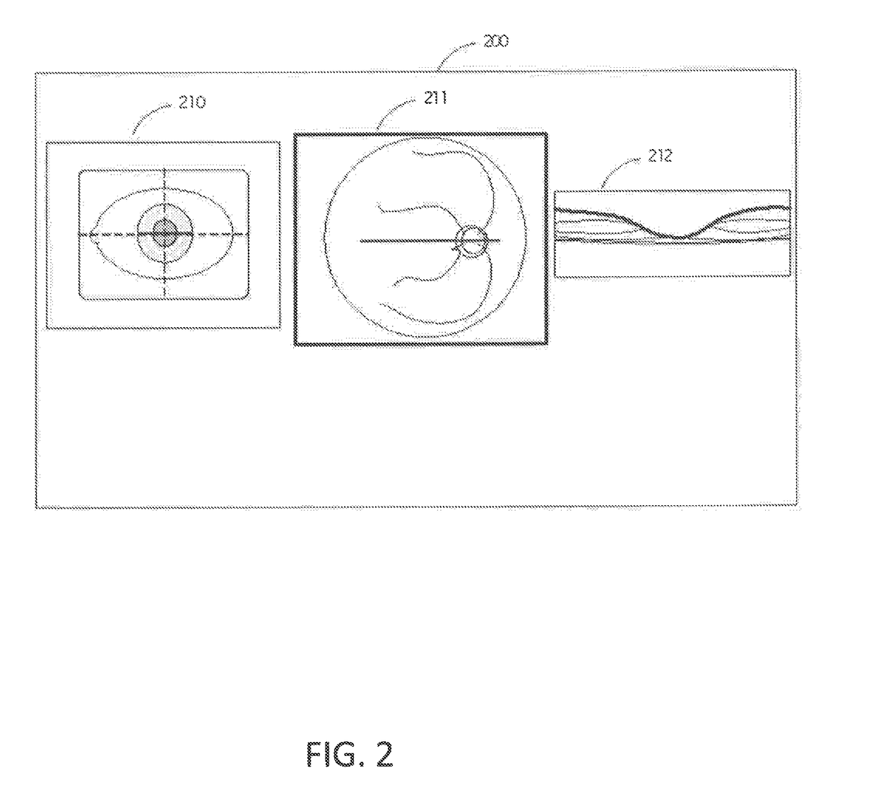 Retinal movement tracking in optical coherence tomography