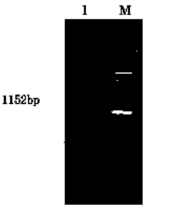 Construction and application of PTEN gene overexpression recombinant adenoviral vectors