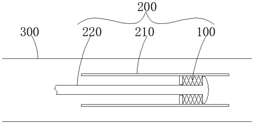 Vascular Stents and Stent Components