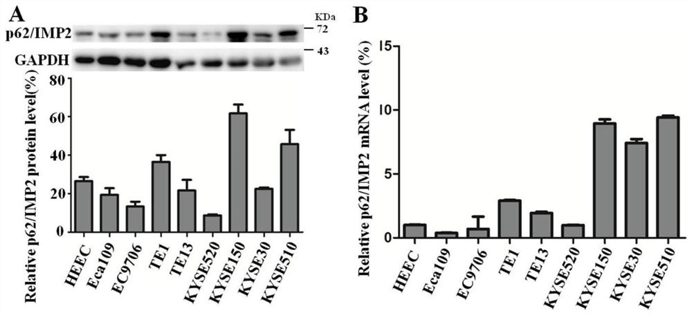 Method for researching influence of tumour-associated antigen p62/IMP2 on esophageal squamous cell carcinoma ESCC