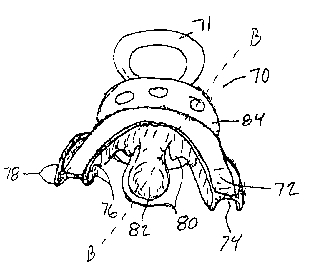Pacifier, a system and a method for maintaining proper dentitions
