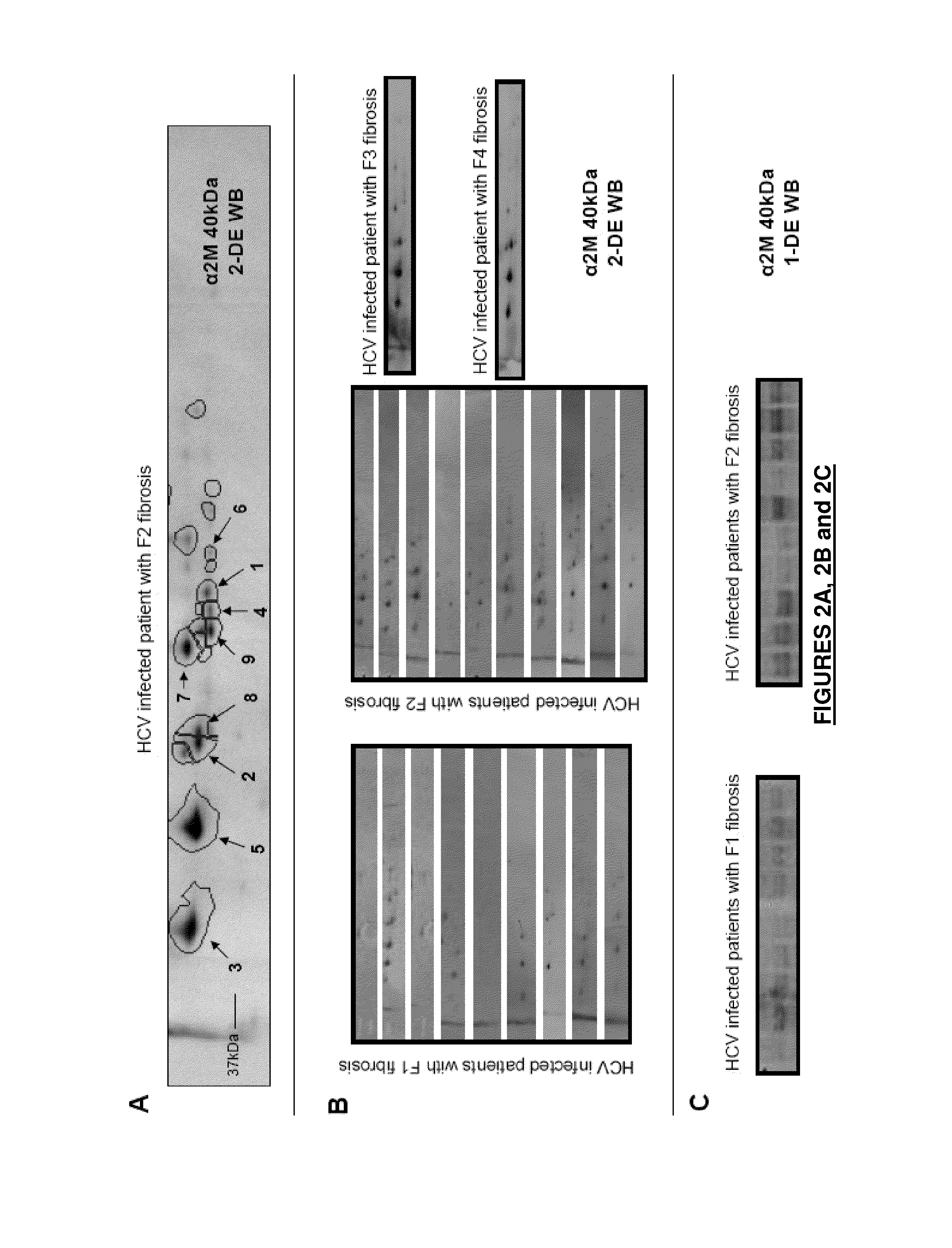 A2m fragments and applications thereof