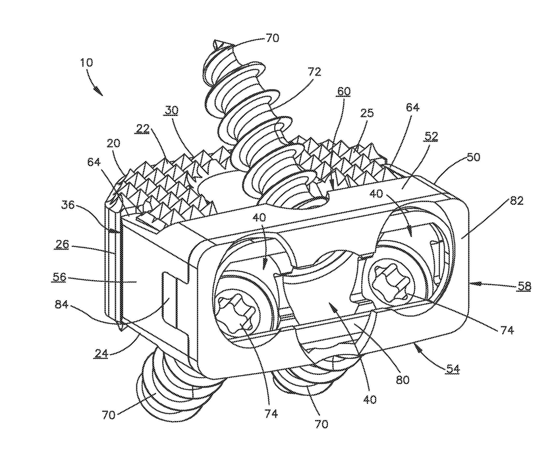 Zero-profile interbody spacer and coupled plate assembly
