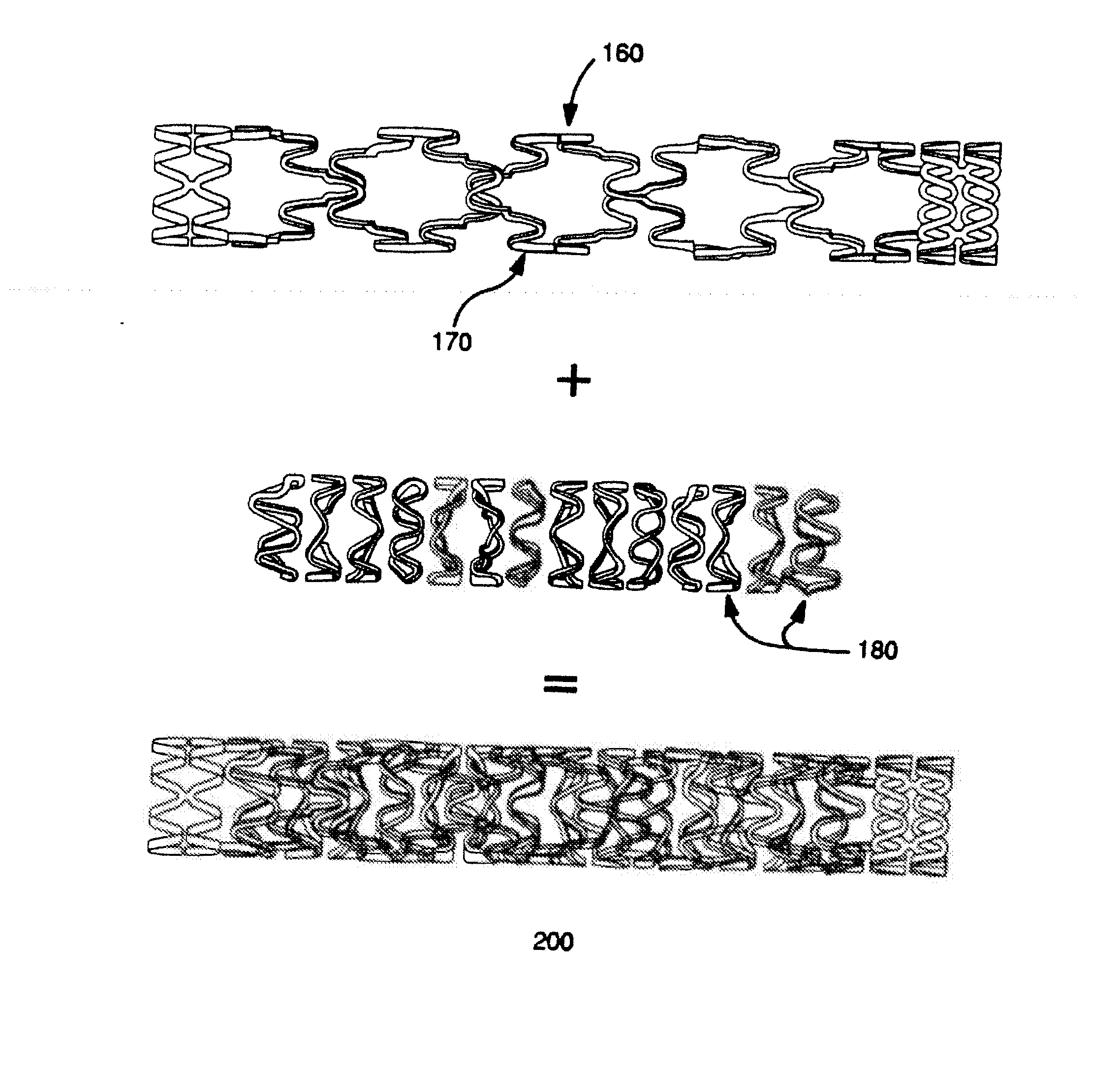 Progenitor endothelial cell capturing with a drug eluting implantable medical device