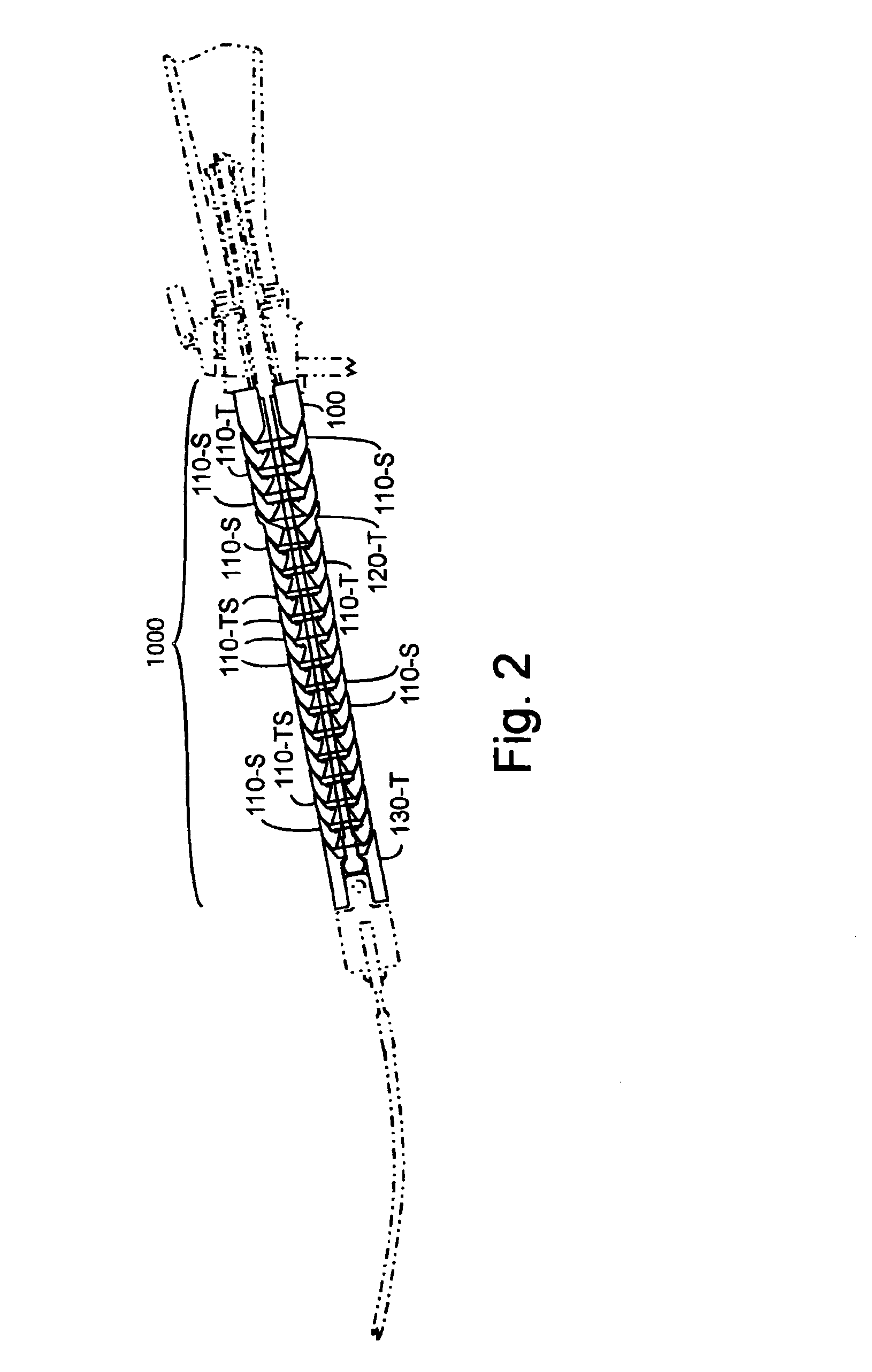 Method and apparatus for improved stiffness in the linkage assembly of a flexible arm