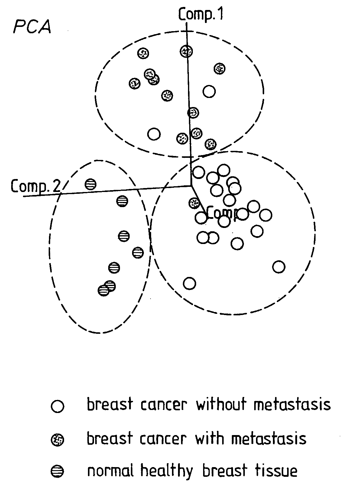 Methods and Kits For the Prediction of Therapeutic Success and Recurrence Free Survival In Cancer Therapy