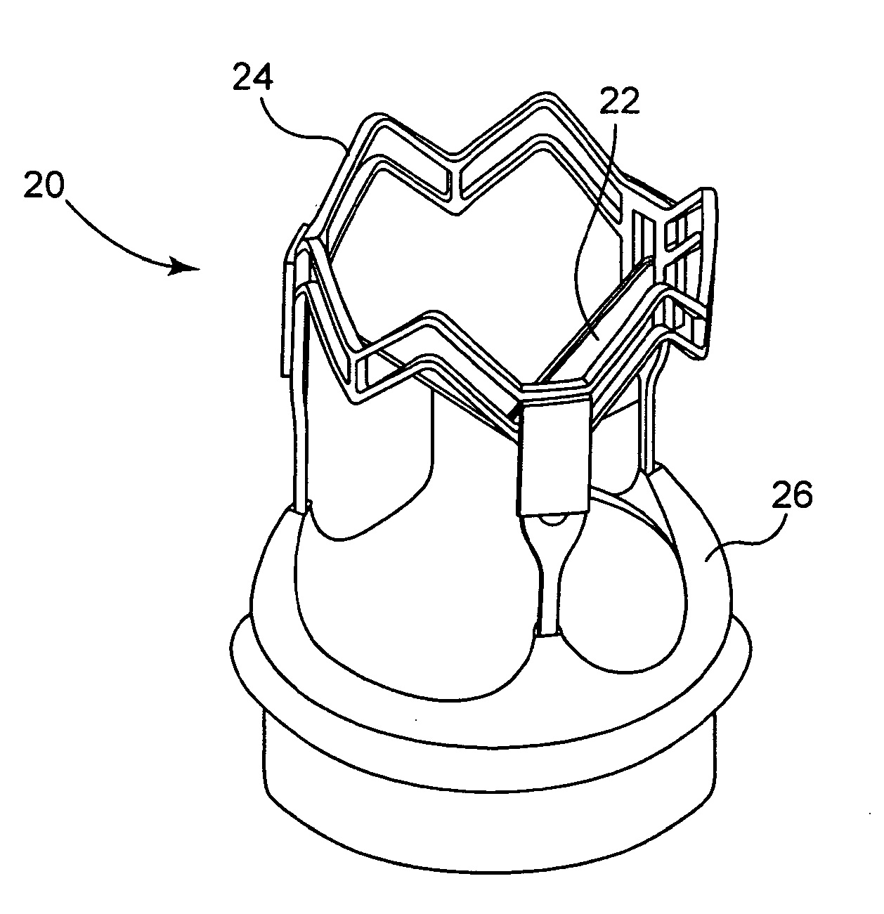 Methods and systems for reducing paravalvular leakage in heart valves