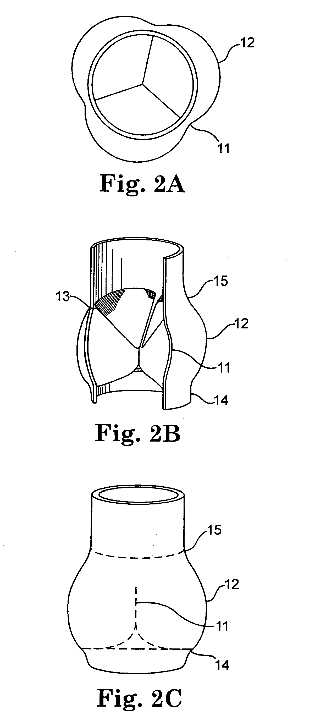 Methods and systems for reducing paravalvular leakage in heart valves