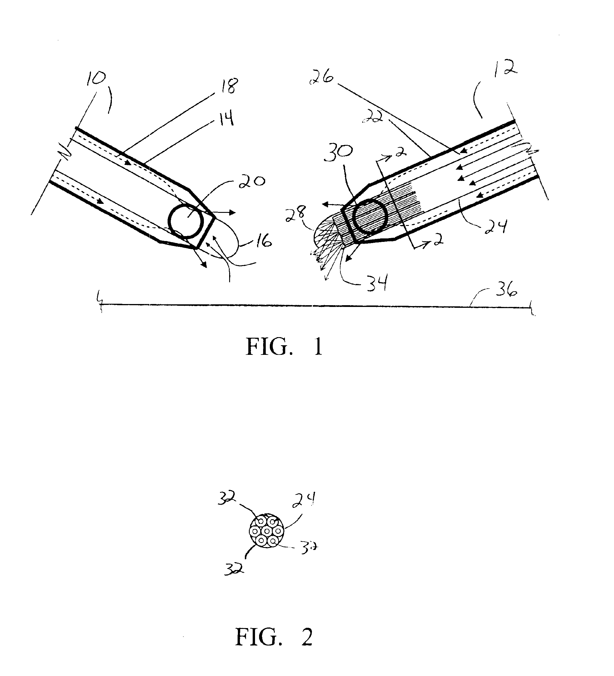 Surgical method and apparatus