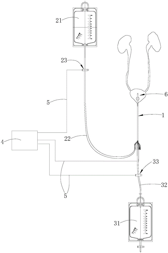 Bladder irrigation and drainage control device