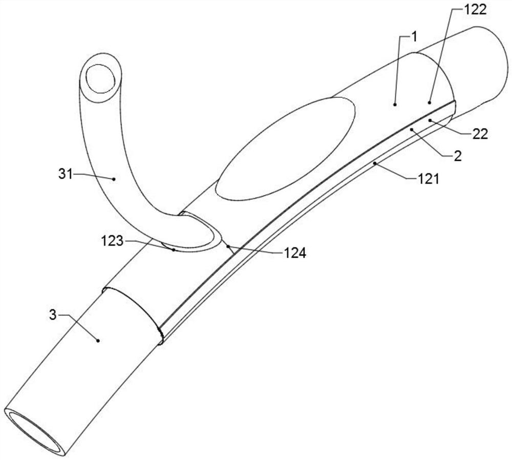 Abdominal artery remodeling device