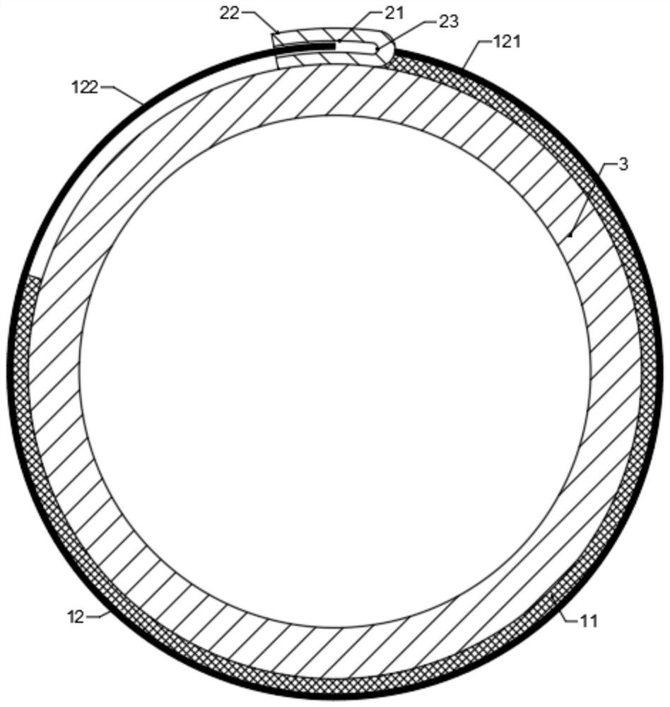 Abdominal artery remodeling device