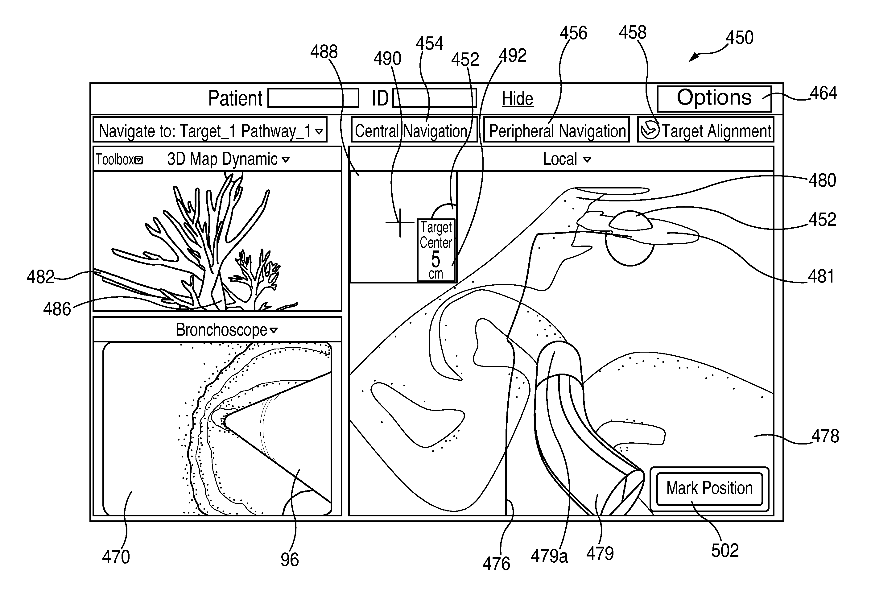 System and method for navigating within the lung