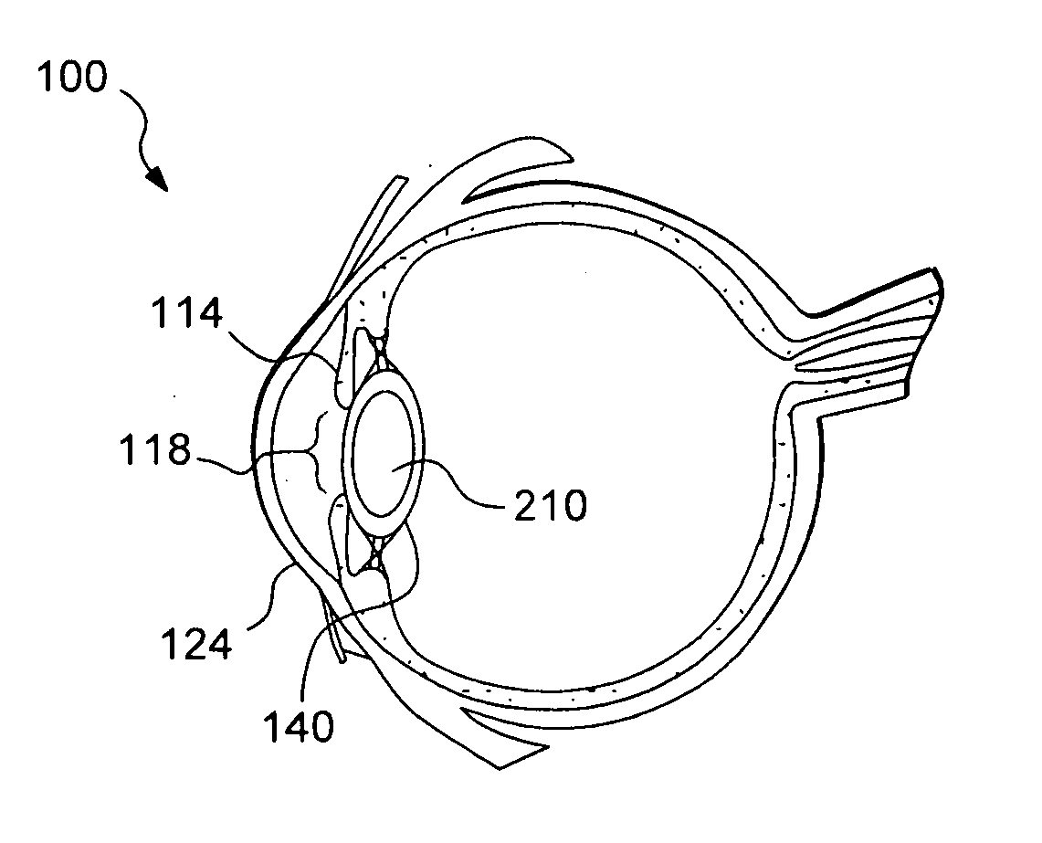 Multi-focal intraocular lens system and methods