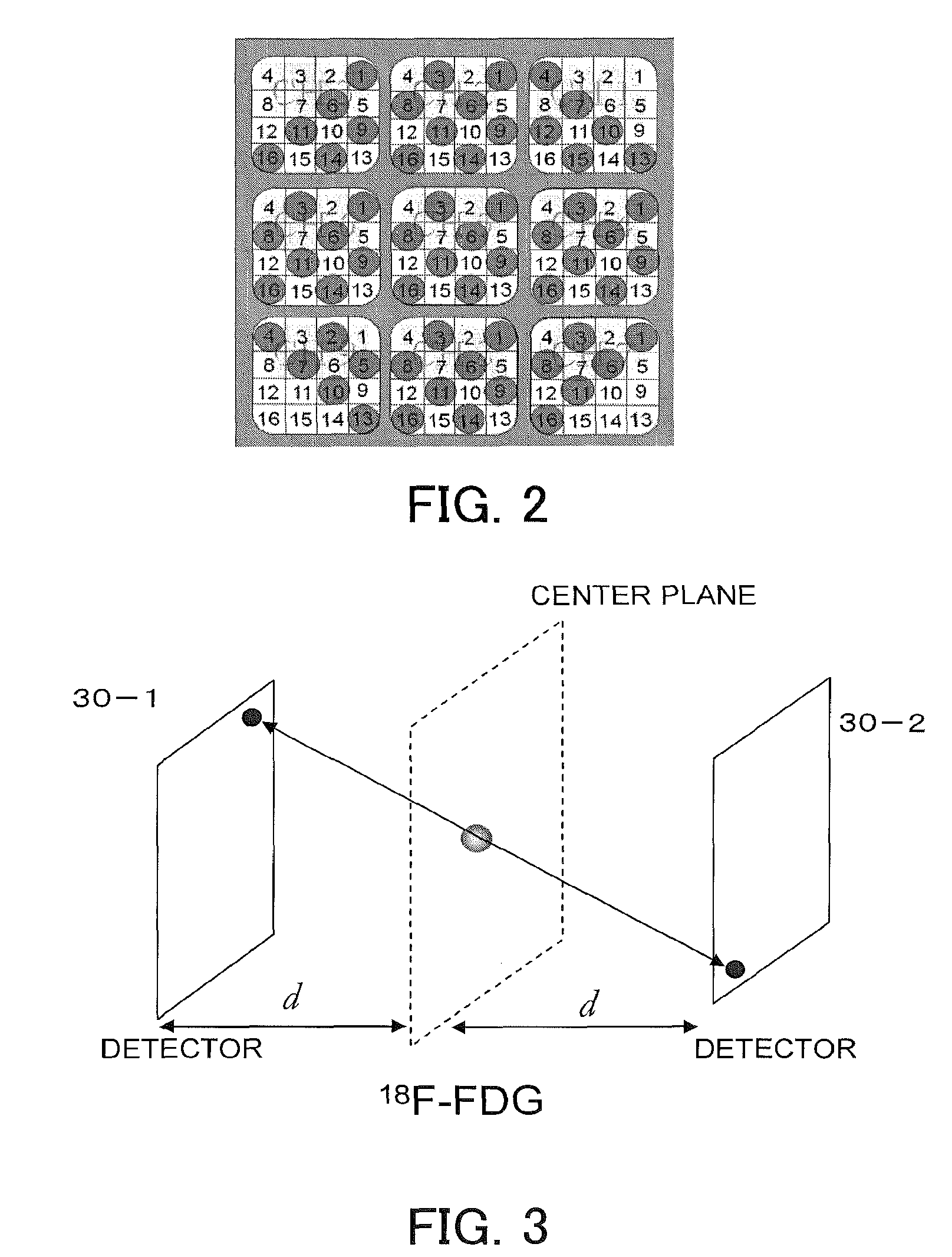 Radiation therapy apparatus