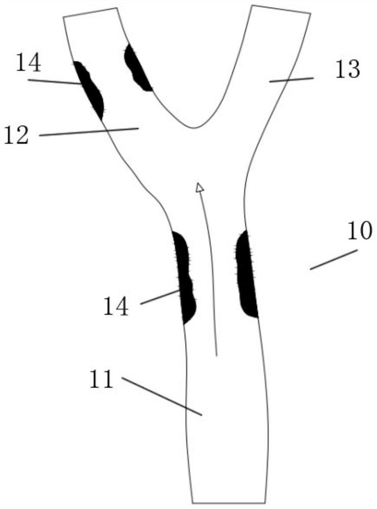 Variable-aperture covered stent