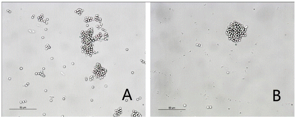 Molecular marker linked with turnip clubroot resistant gene and method for obtaining molecular marker