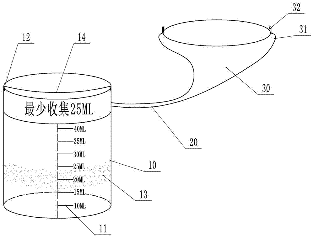 A urine sample bottle and a method for using the same