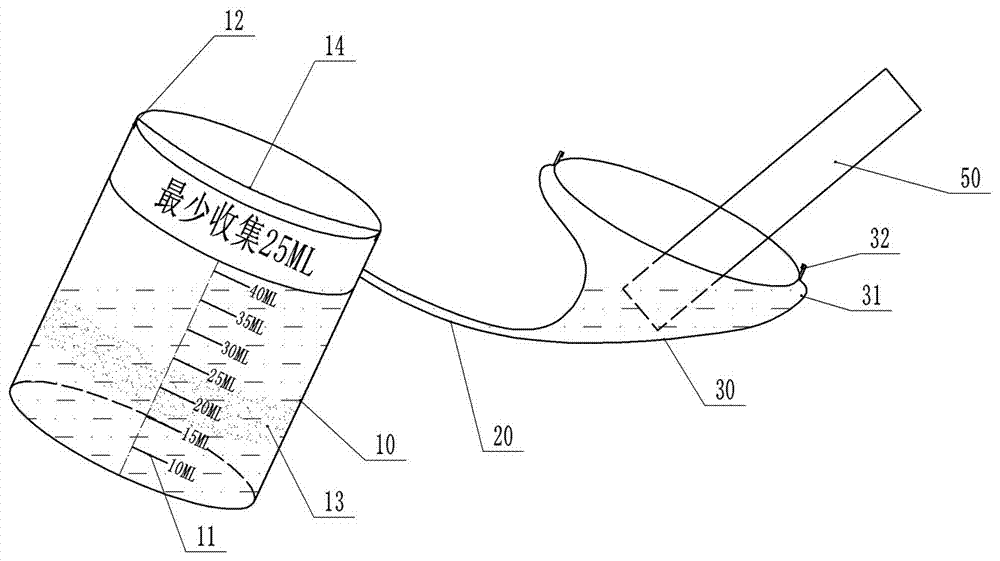 A urine sample bottle and a method for using the same