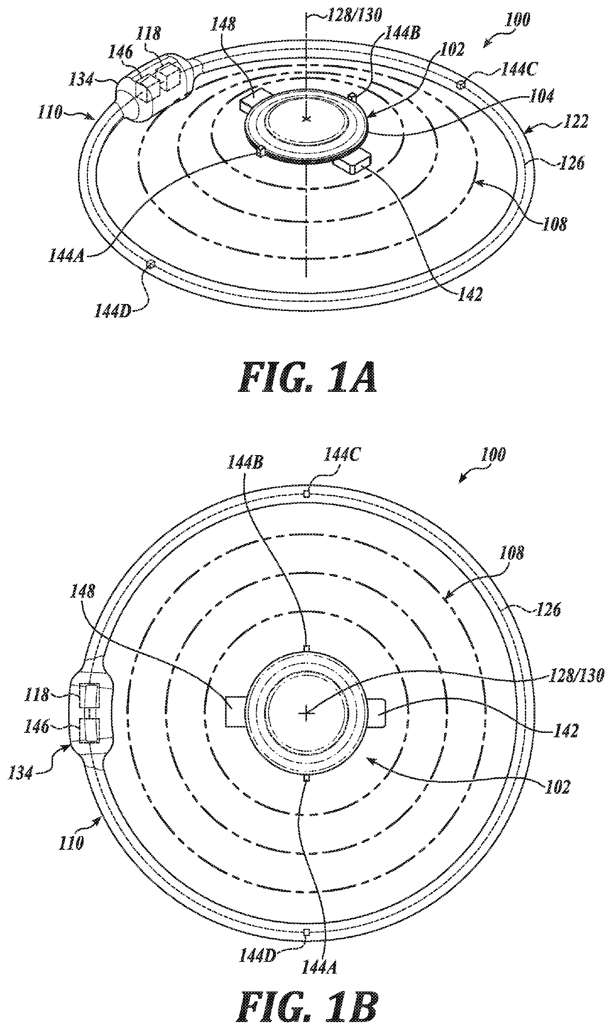 Ophthalmic system including accommodating intraocular lens and remote component and related methods of use