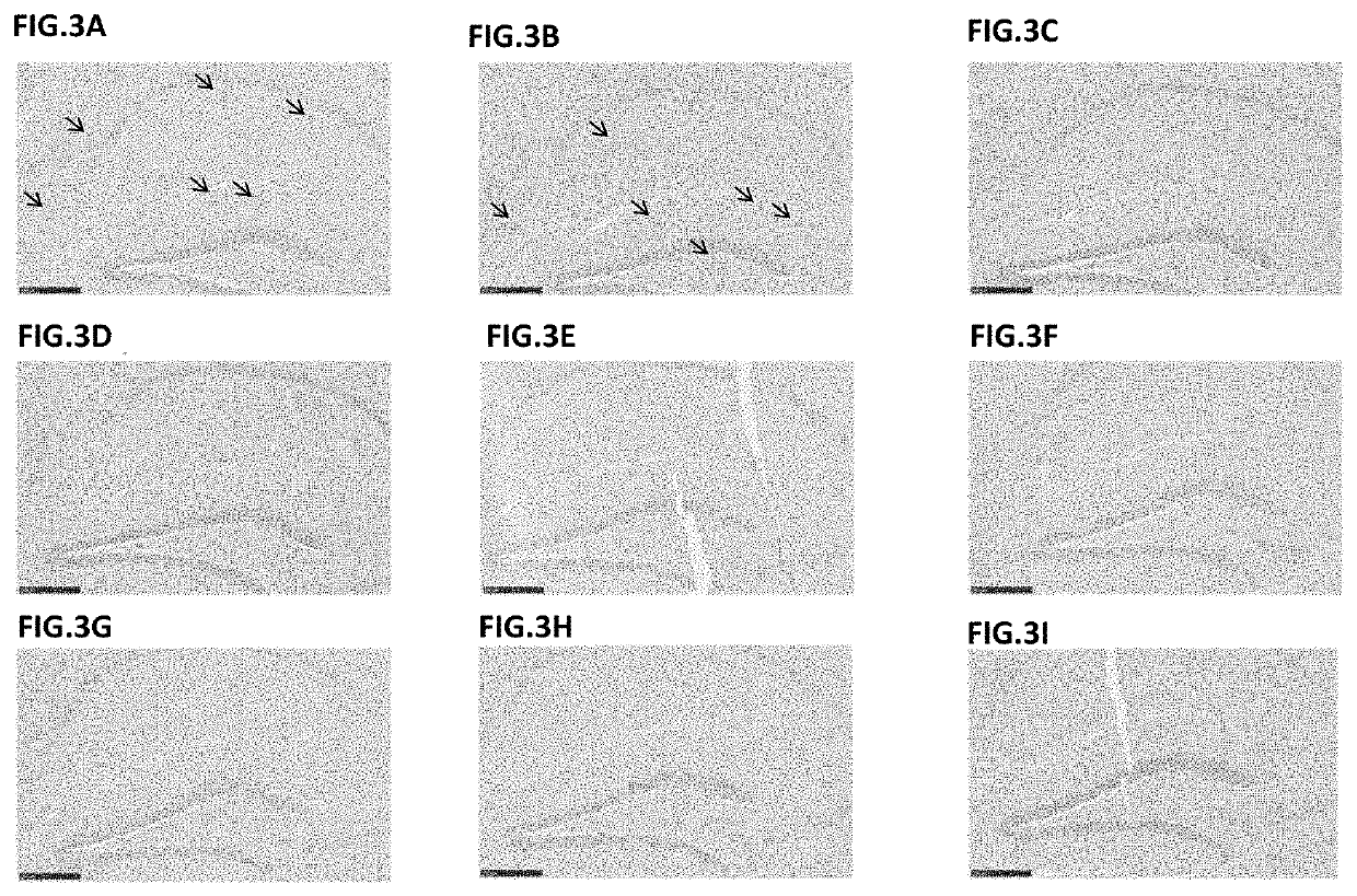 Antibodies to pyroglutamate amyloid-β and uses thereof