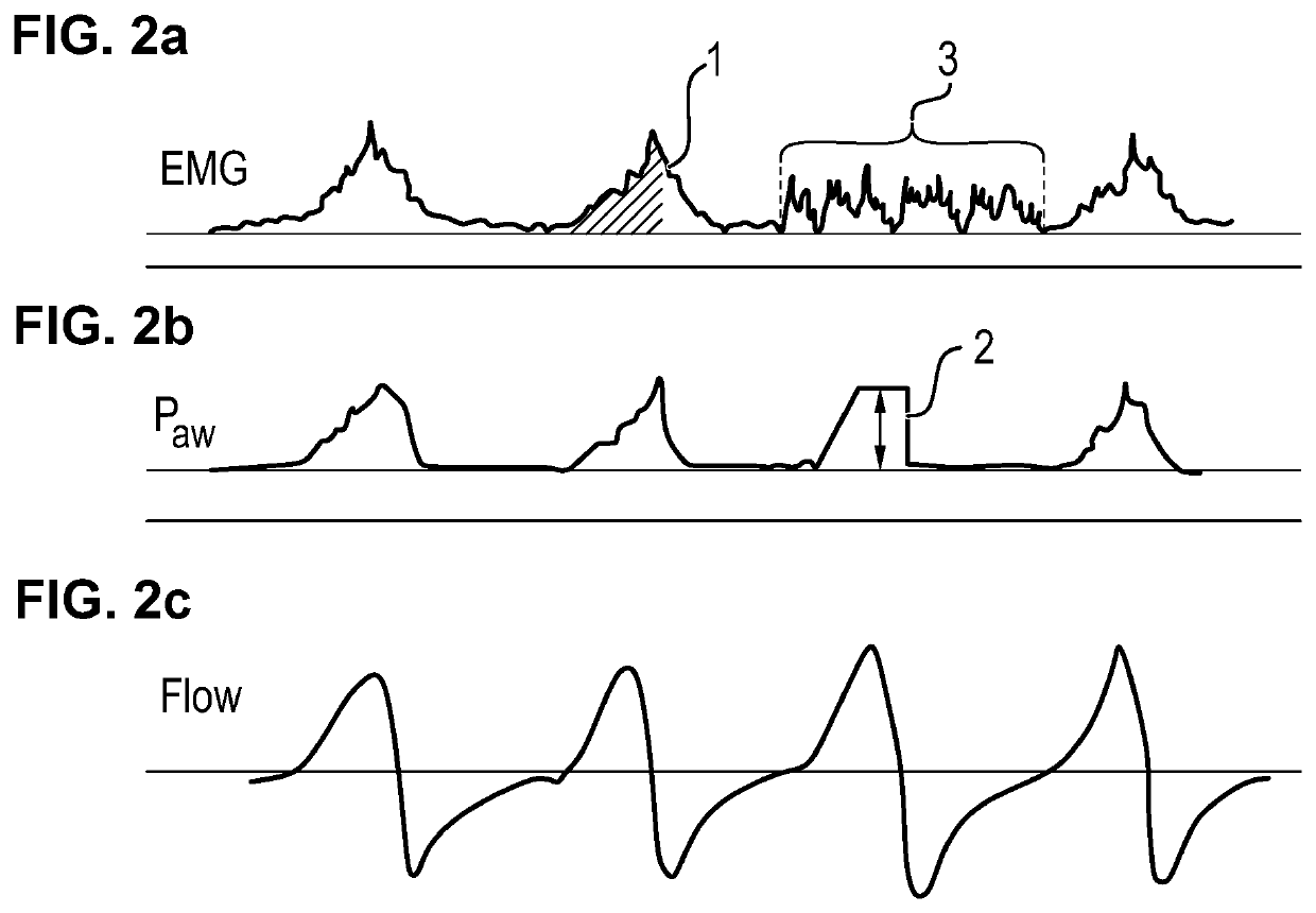 Device for the pressure-supported or pressure-controlled ventilation of a patient with reduced spontaneous breathing