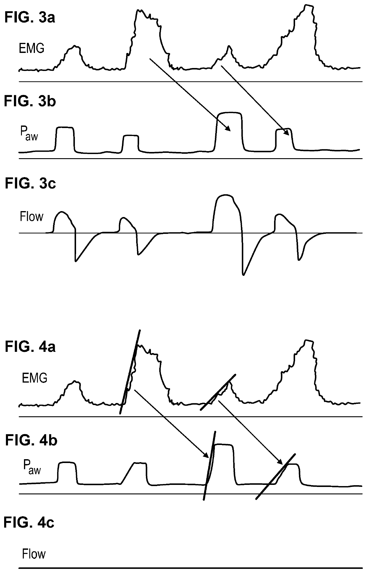 Device for the pressure-supported or pressure-controlled ventilation of a patient with reduced spontaneous breathing