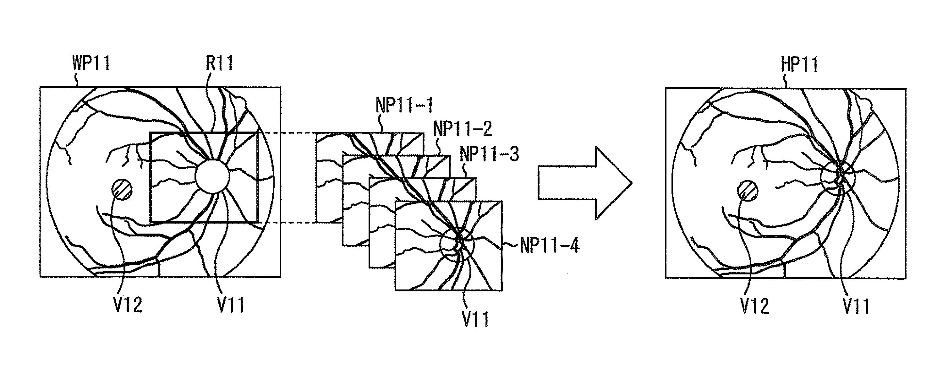 Image processing device and method, eye fundus image processing device, image photographing method, and eye fundus image photographing device and method