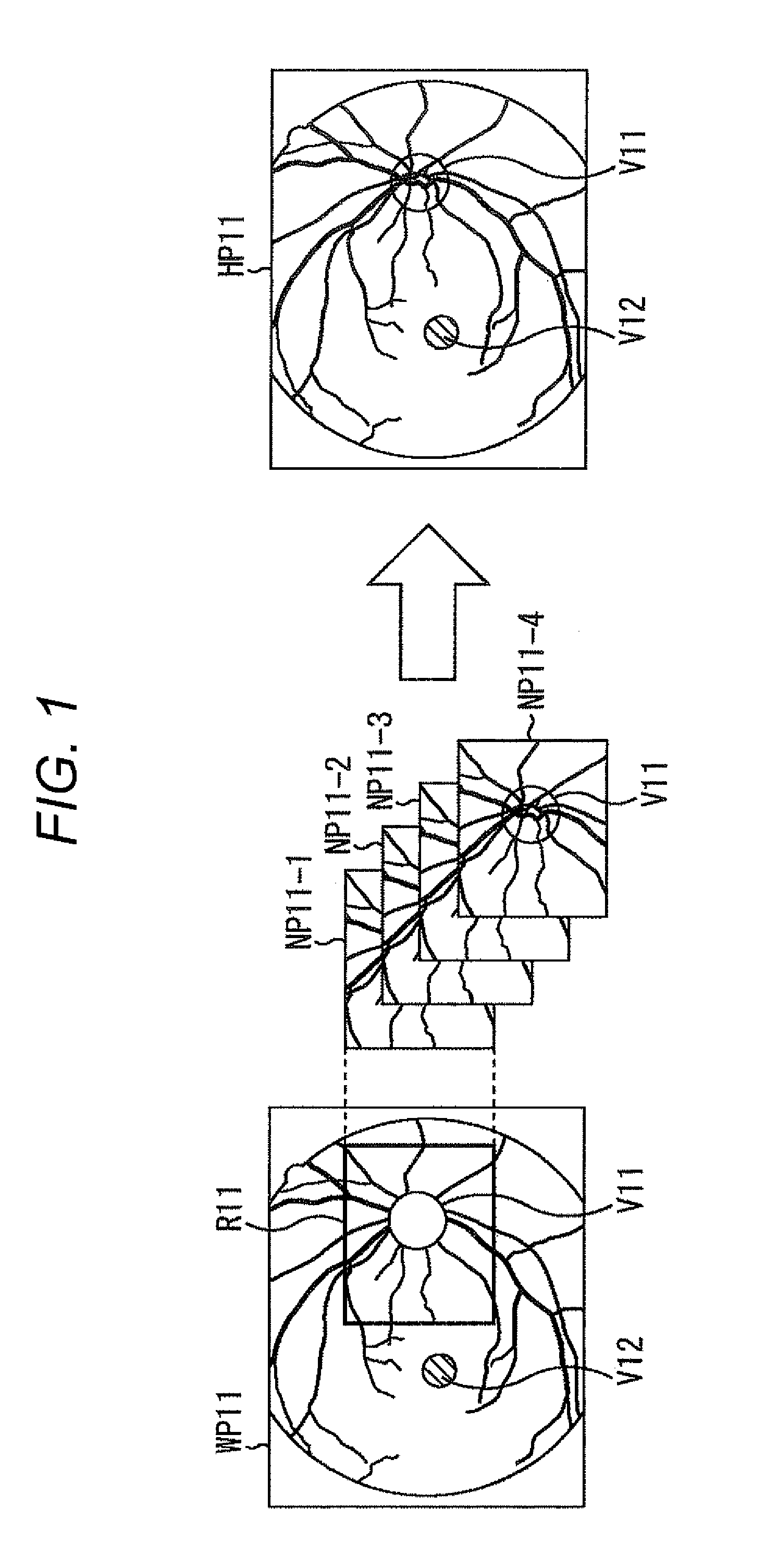 Image processing device and method, eye fundus image processing device, image photographing method, and eye fundus image photographing device and method