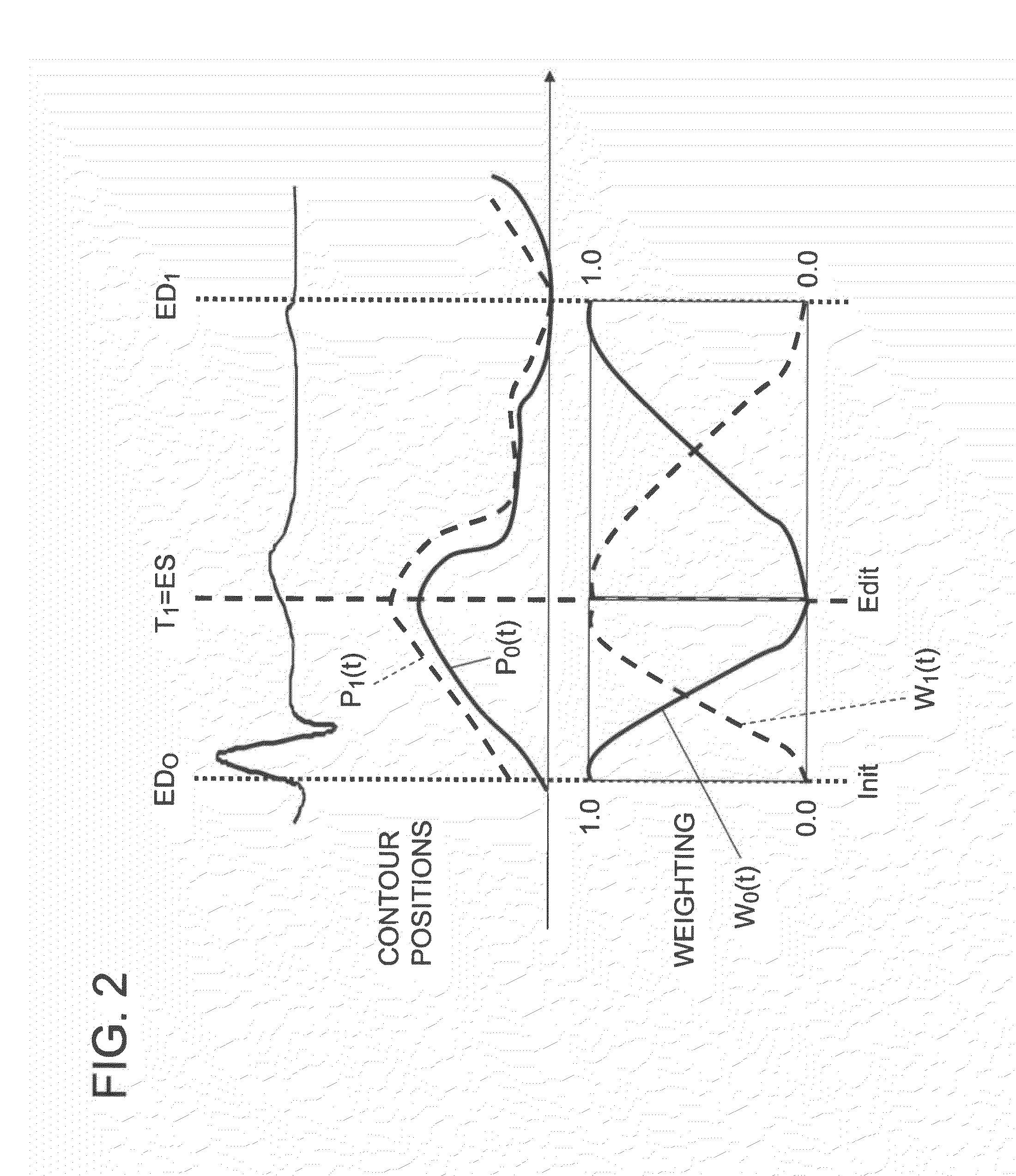 Medical imaging apparatus, medical image processing apparatus, ultrasonic imaging apparatus, ultrasonic image processing apparatus and method of processing medical images