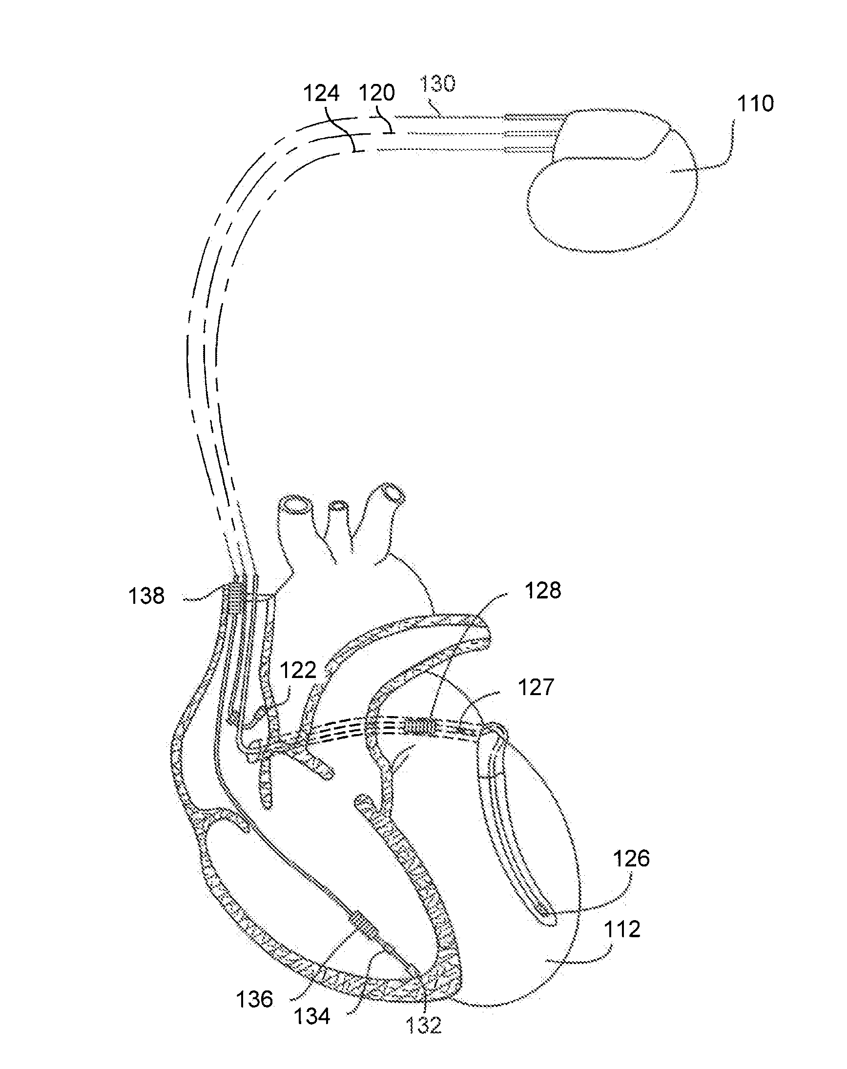 Implantable medical devices, and methods of use therewith, that detect exposure to magnetic fields from MRI systems