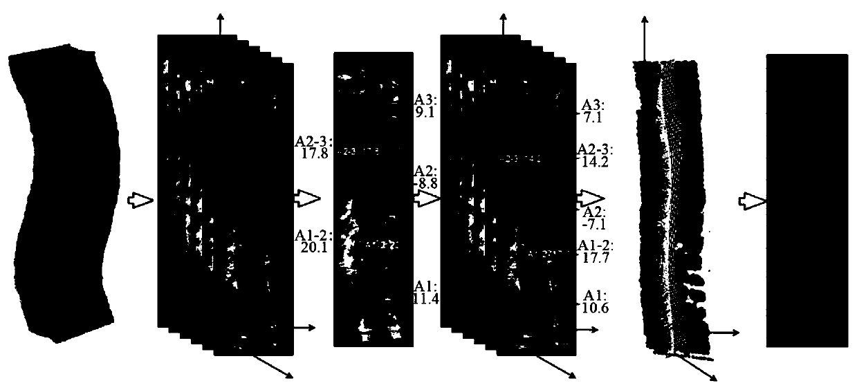 Three-dimensional ultrasonic spinal data based sagittal plane projection imaging method