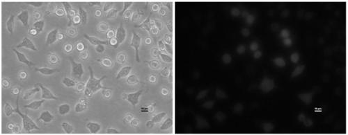 Engineering-transformed macrophages and application of macrophages to septicopyemia