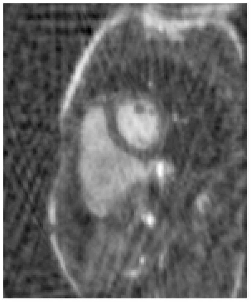 A method for sparse mri reconstruction based on a combination of convolutional neural networks and iterative methods