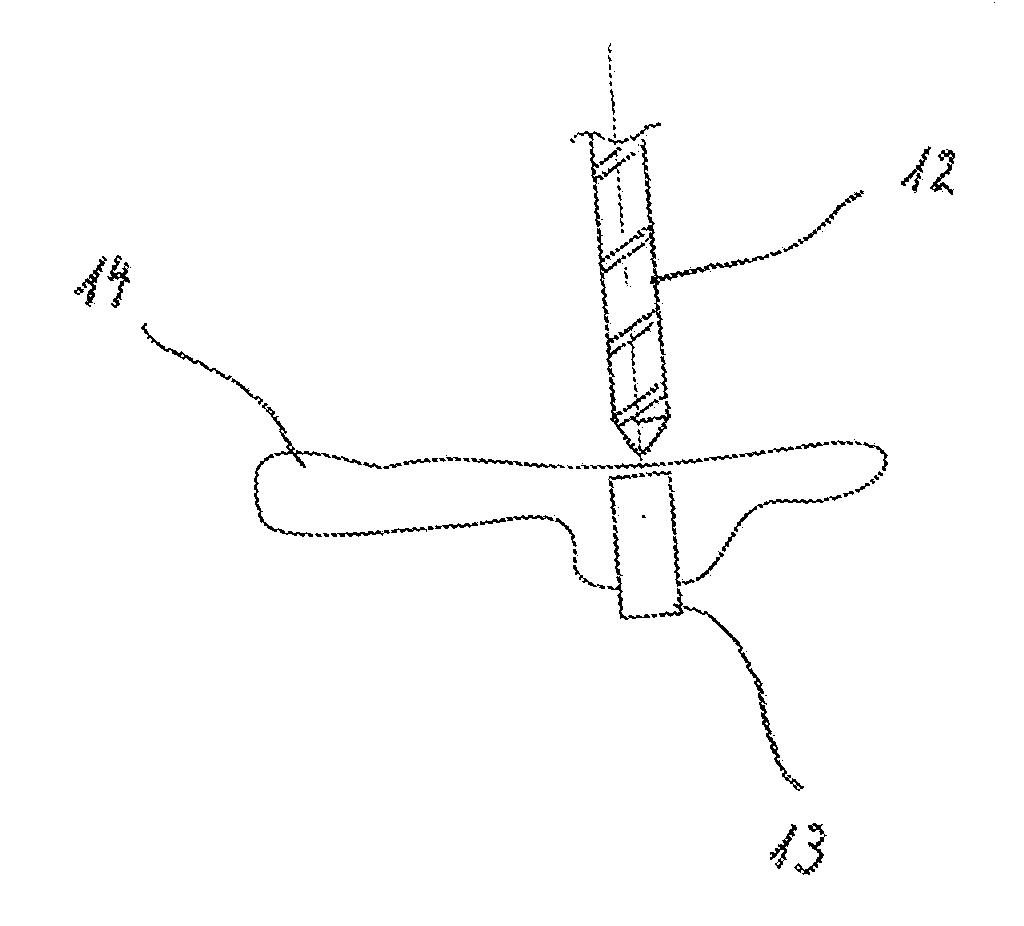 Method For Producing Individual Drilling Templates For Dental Implant Surgery In A Patient's Jawbone
