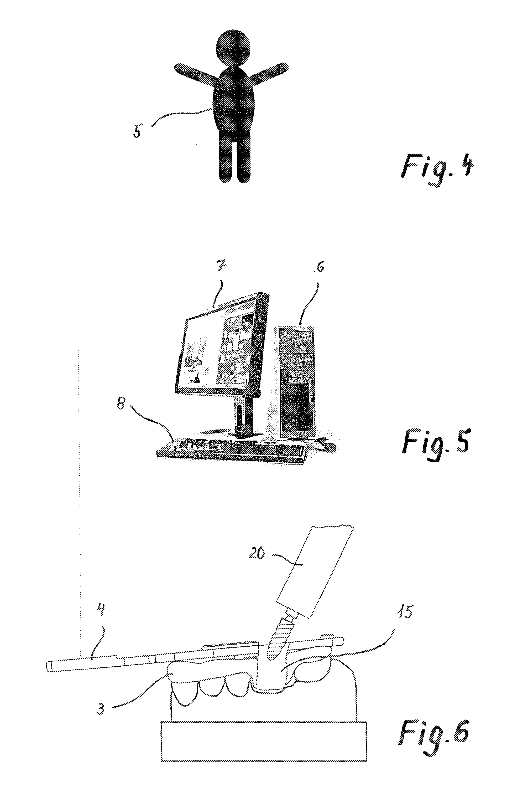 Method For Producing Individual Drilling Templates For Dental Implant Surgery In A Patient's Jawbone