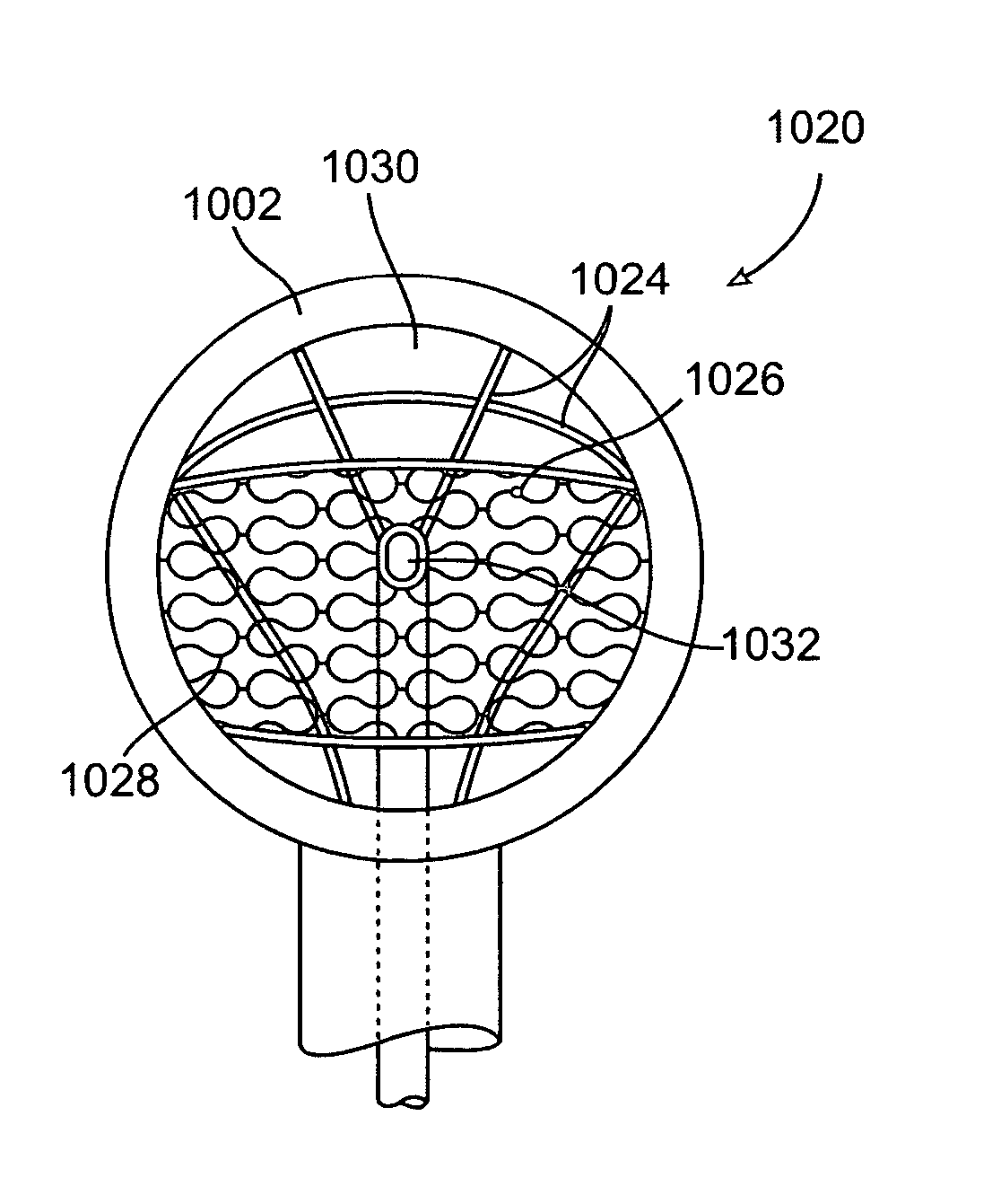 Methods and electrode apparatus to achieve a closure of a layered tissue defect